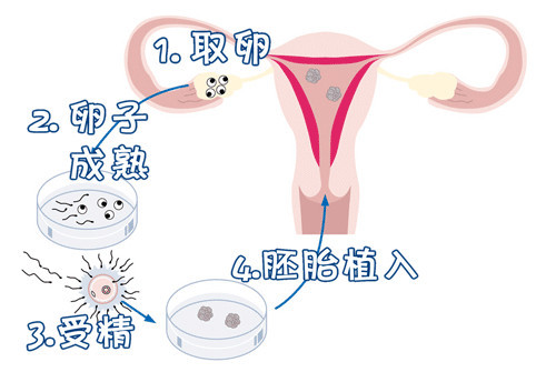 遗传阻断案例